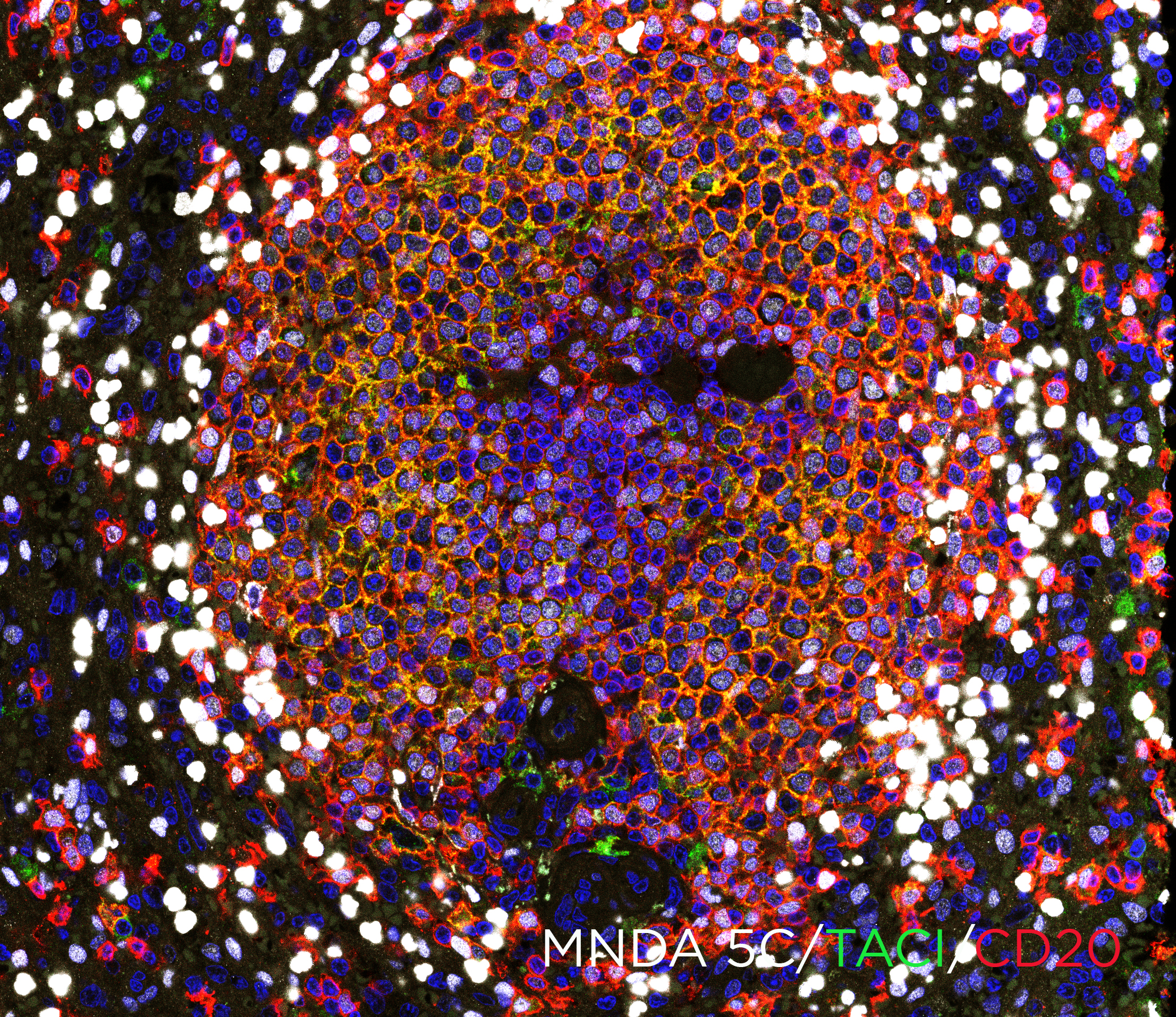 MNDA antibody IF Characterisation: Endogenous expression