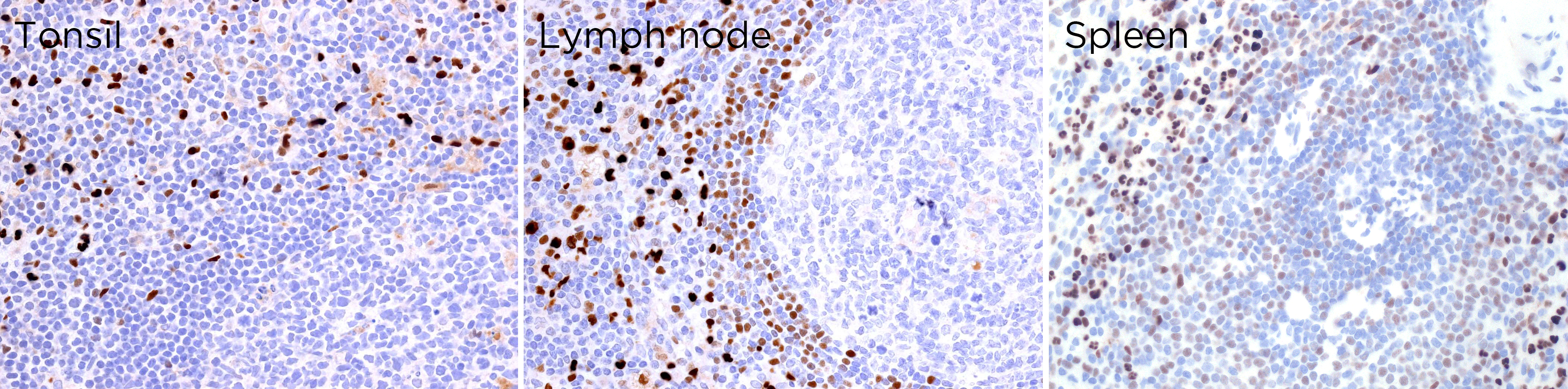 MNDA antibody IHC-P Characterisation: Endogenous expression