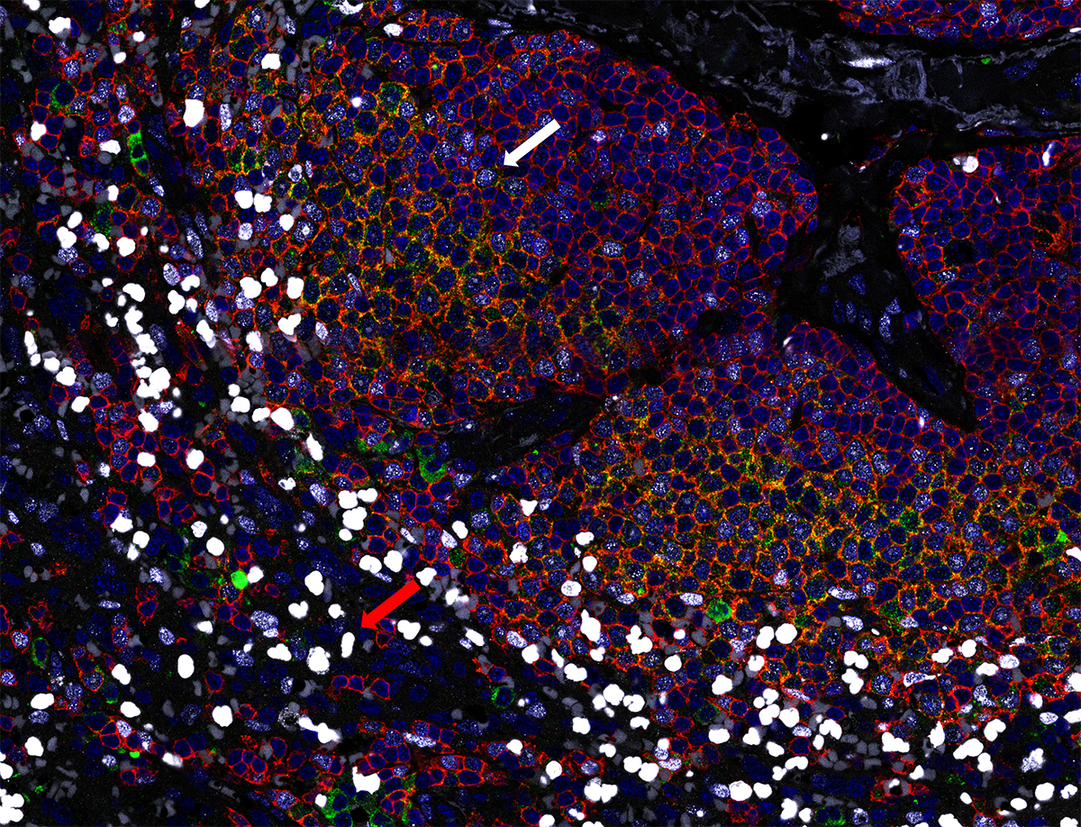 MNDA antibody IF Characterisation: Endogenous expression