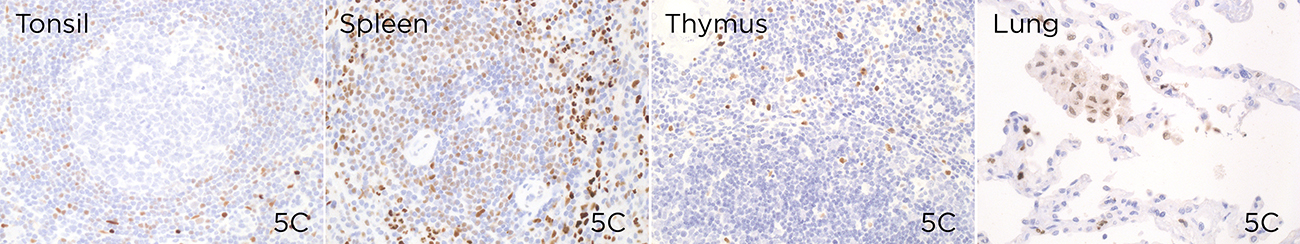 MNDA antibody IHC-P Characterisation: Endogenous expression