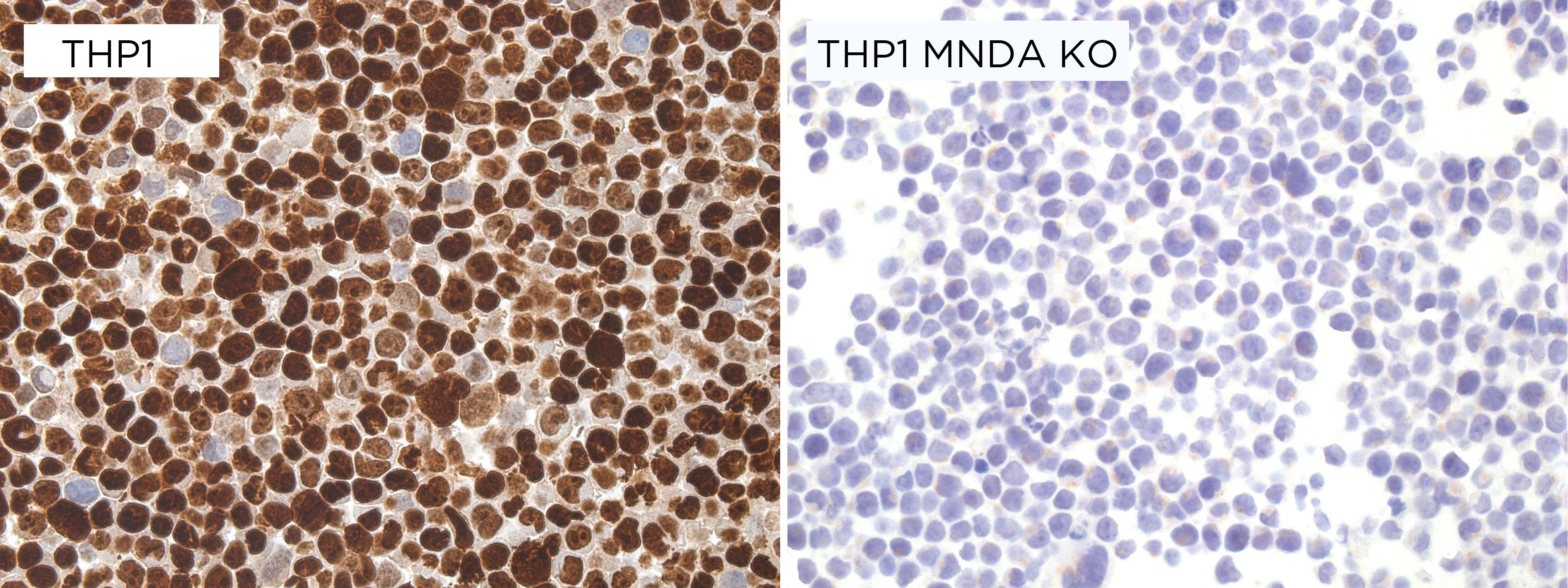 MNDA antibody ICC Validation: Gene inactivation
